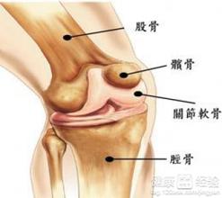 髕骨骨折主要原因及癥狀